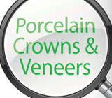 crowns-veneers