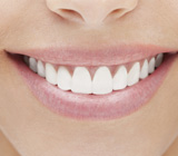 tooth-contouring