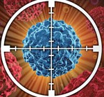 oral-cancer4