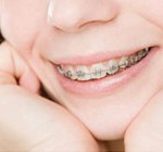 orthodontics